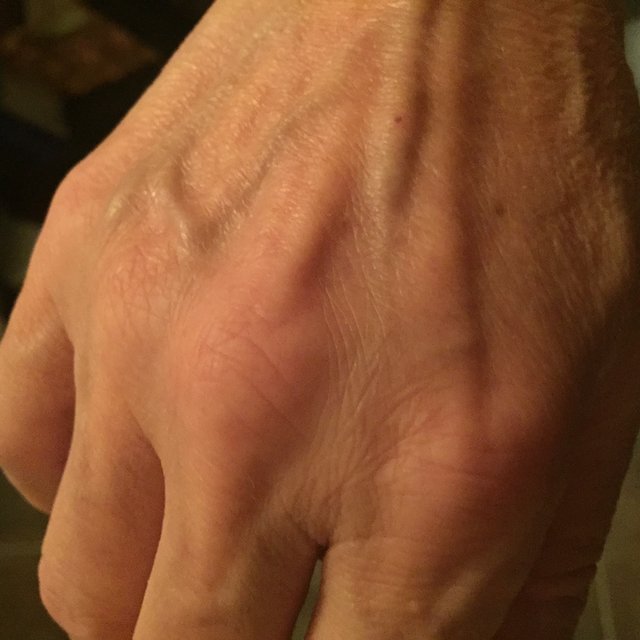 QueenBee's Hand after Honey Body Product Treatment